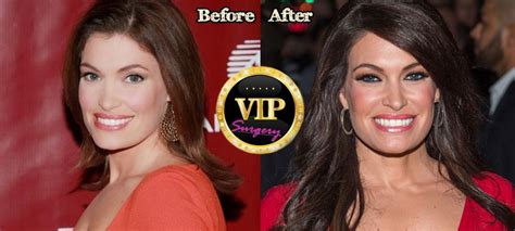 Kimberly guilfoyle surgery. Things To Know About Kimberly guilfoyle surgery. 